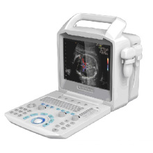 Portable 2D Color Doppler Ultrasound Scanner